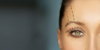 estetica ocular innova ocular blefaroplastia