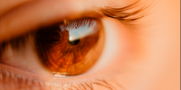 glaucoma ojo