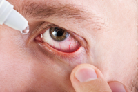 infeccion ocular conjuntivitis